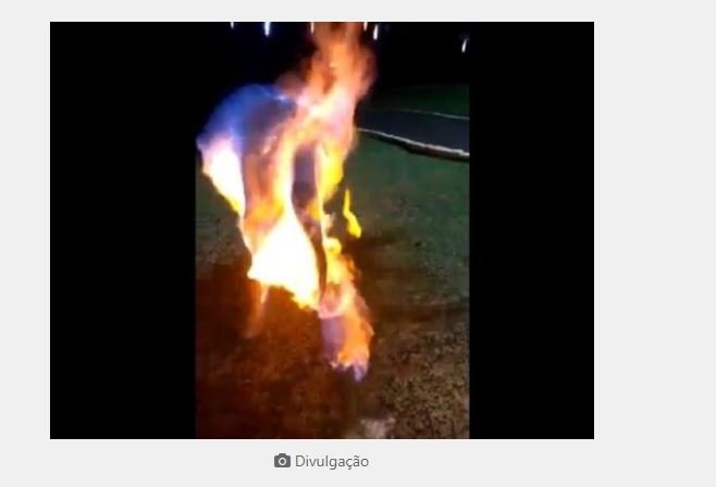 Marido em fúria queima esposa usando álcool em gel