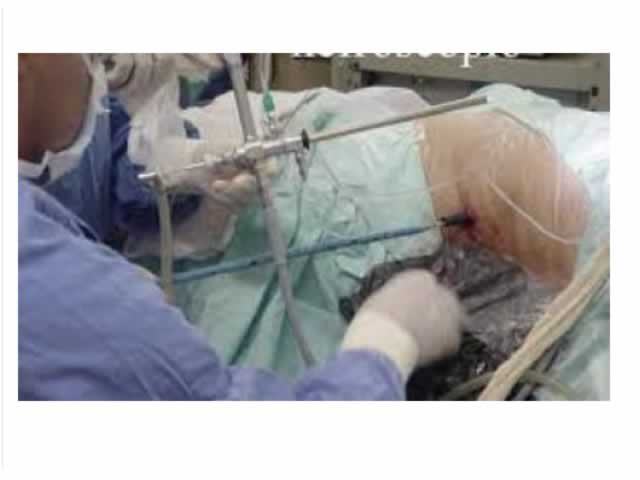 Sem Vara, hospitais superfaturam cirurgias em até 1000% em MT; veja documentos