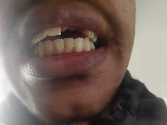 Acusado de abuso sexual é agredido e perde dente da frente