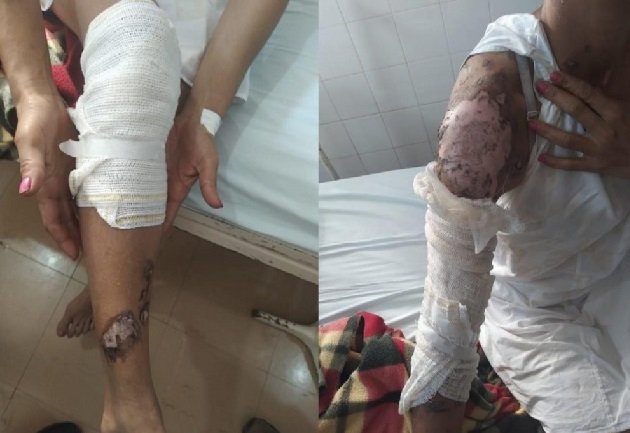Mulher flagra traição e é jogada em fogueira de festa junina pela amante do marido