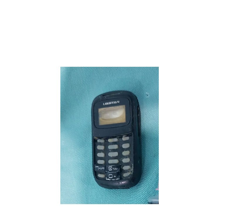 Preso passa por cirurgia após engolir celular e aparelho não sair