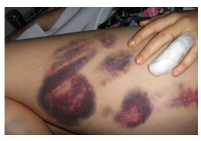 Jovem espanca namorada após ela postar foto no Facebook