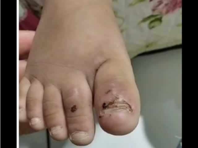 Mãe é presa por maltratar criança com deficiência visual em MT. (Fotos)