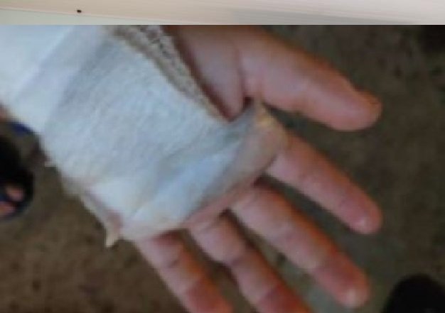 Por amor, mulher faz tatuagem e tem mão esfaqueada pelo marido