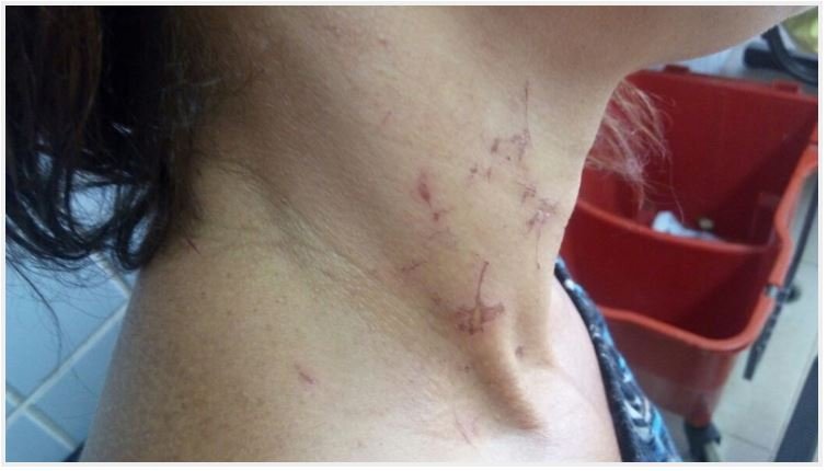 Homem é preso após agredir ex-mulher e o atual namorado dela com socos no rosto