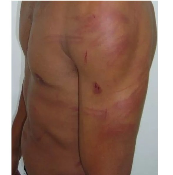 Homem é agredido por ex-mulher com facadas, mordidas e unhadas; Ele foi encontrado caído