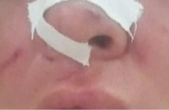 Homem tenta agredir esposa e quebra nariz de filho no murro