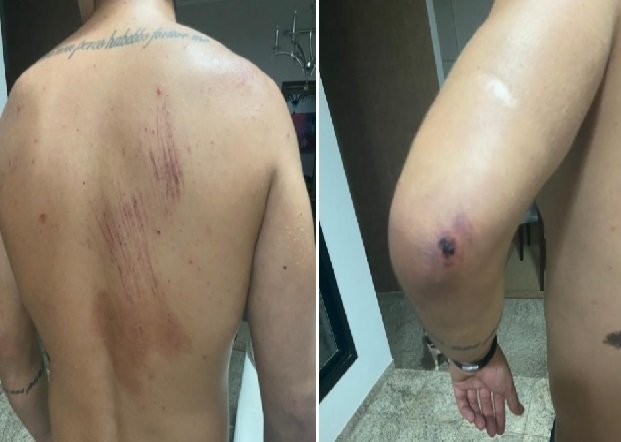Estudante de medicina bate em carro de PM e é agredido após provocar militar