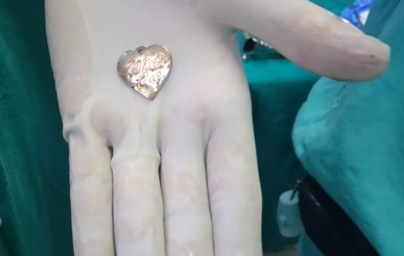 Menina de 3 anos engole broche da roupa da mãe e é internada na UTI