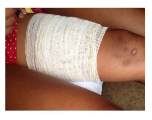 Filho bate no pai e acaba sendo baleado pelo irmão em MT