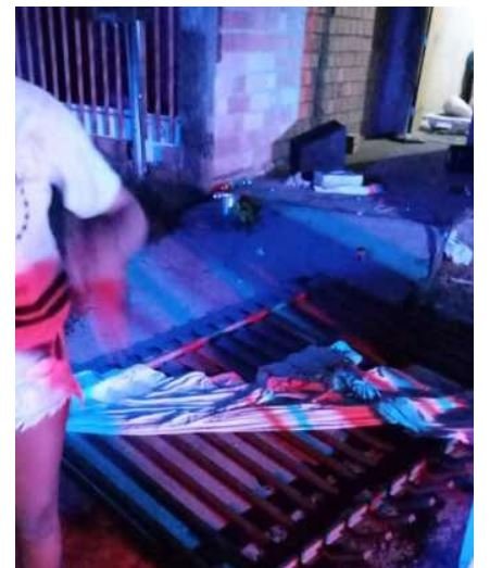 Criança de 2 anos sofre traumatismo craniano ao cair do colo de vizinha