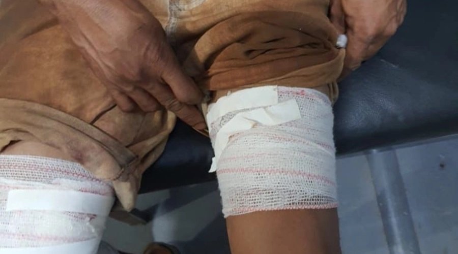 Homem atira acidentalmente na própria perna ao tentar matar porco