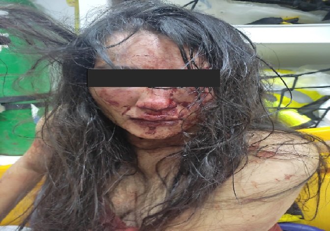 Marido é preso pela PM após deformar rosto de esposa com socos e chutes