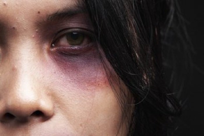 Homem tem crise de ciúmes e espanca mulher com chutes e socos no rosto