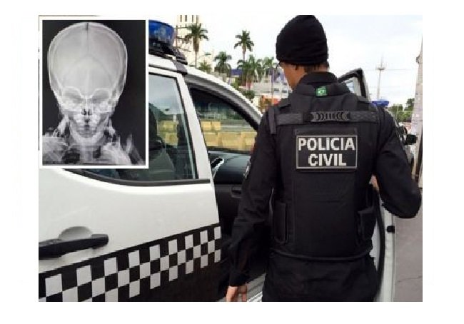 Polícia investiga padrasto por agressões a bebê de 10 meses