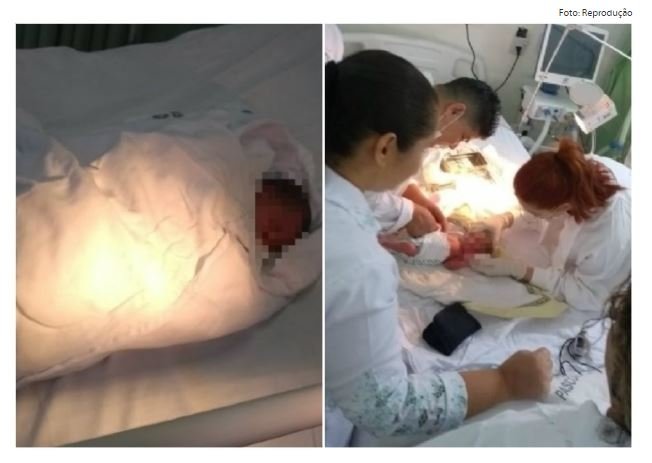 Recém-nascido encontrado coberto de formigas deve receber alta esta semana