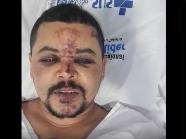 Adv Wilson ‘Secretario’ funcionário da Pref. de Colíder se recupera bem e espera alta essa semana. (Vídeo)