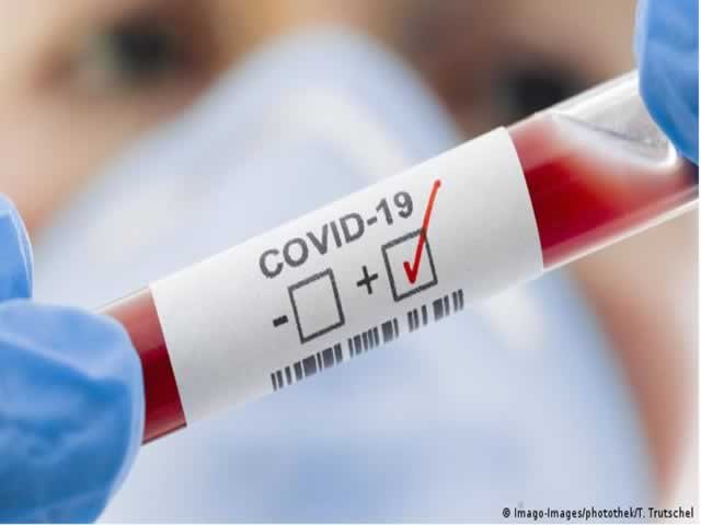 Colíder já contabiliza 08 pessoas internadas com COVID-19.