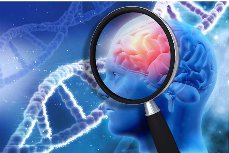 Medicamento para HIV pode ser alternativa para tratar Alzheimer