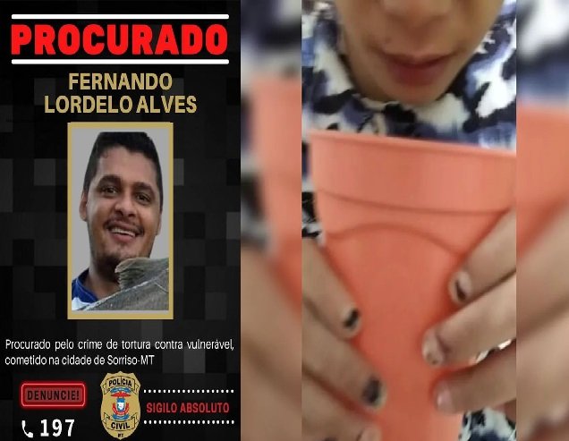 Há cinco meses, Fernando acusado de quebrar costelas e torturar enteada cega com alicate está foragido