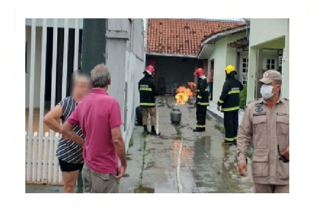 Idoso sofre queimaduras em mais de 18% do corpo tentando conter fogo em botijão de gás