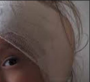 Mãe é detida suspeita de espancar a própria filha de 2 anos que precisou ser entubada em MT