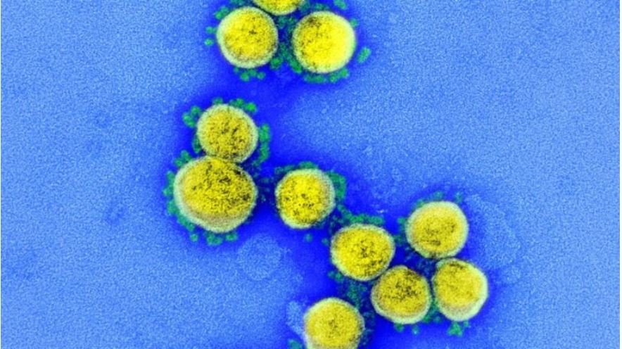Estudo indica presença da Ômicron em MT