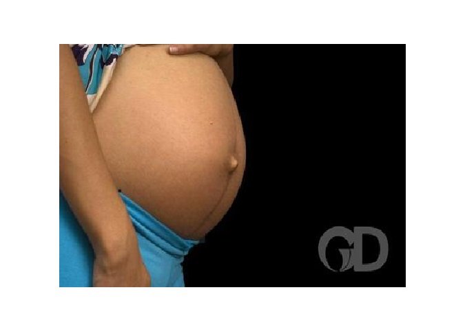 Menor de 17 anos esfaqueia a namorada grávida de 5 meses na região da lombar