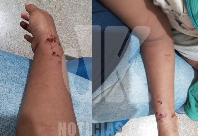 Menina, de 07 anos, fica ferida após ser atacada por gato