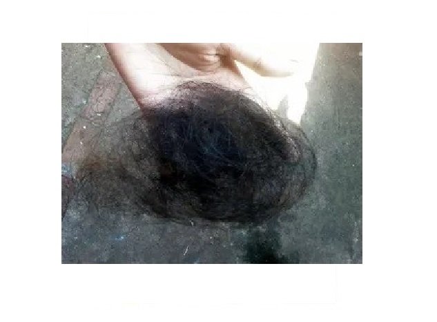 Mulher é agredida e tem cabelo arrancado por colega de trabalho