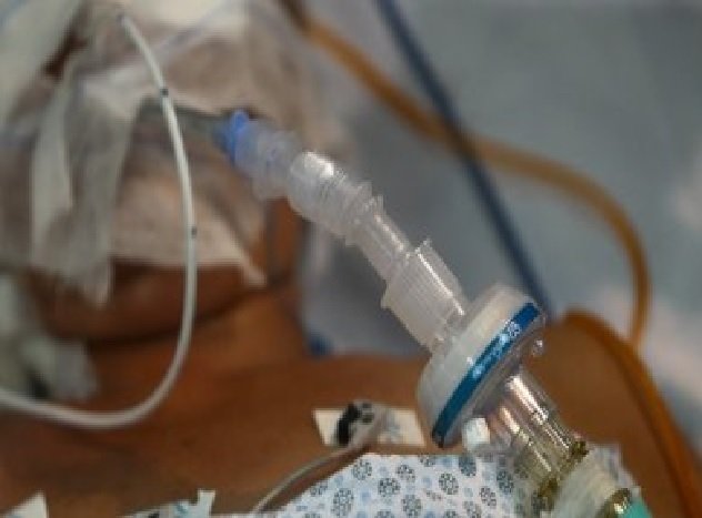 MT registra cinco mortes e 3,5 mil de casos de Covid; UTIs estão lotadas