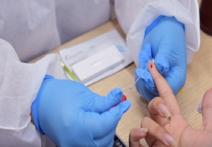 Em 24h, Mato Grosso registra 4,8 mil casos e 26 mortes por Covid