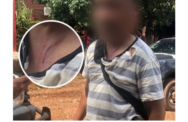 Travesti agride delegado e investigador da DHPP durante ocorrência de homicídio