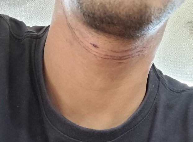 Empresário quase é degolado por fio de internet caído em cidade de MT