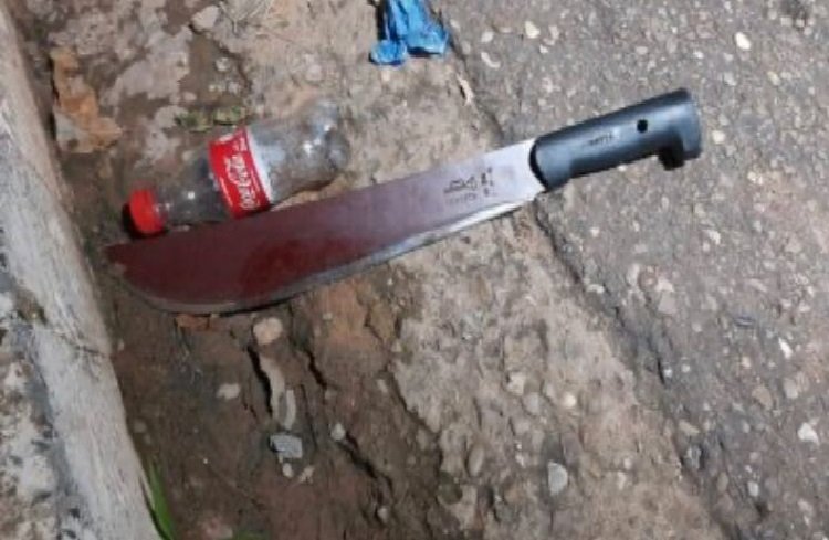 Mulher quase decepa mão do marido após ser espancada por ele no interior de MT