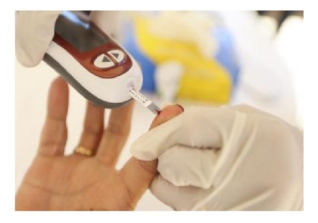 Entenda como uma pessoa saudável pode desenvolver diabetes pós-covid