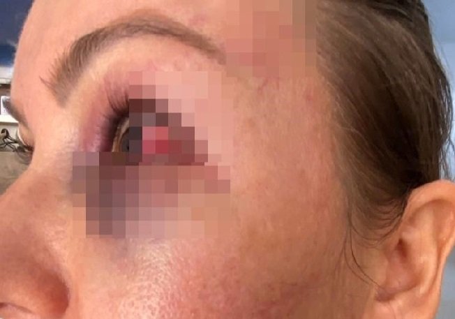 Mulher é amarrada e espancada pelo marido dentro de carro no interior de MT