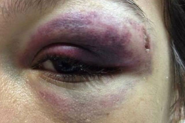 Em Colíder mãe e filha são brutalmente agredidas e ameaçadas de morte.