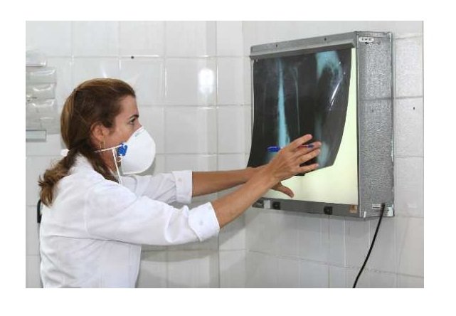 MP processa prefeitura por não divulgar lista de pacientes que aguardam procedimentos