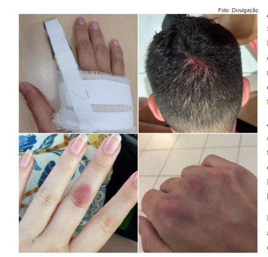 Candidatos a cargos na polícia em MT ficam lesionados após teste de aptidão física e alegam cobranças em excesso