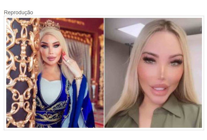 Jessica Alves mostra resultado de feminização facial feita na Tailândia
