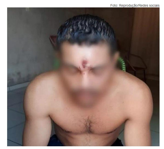 Homem leva tiro na testa, cai de moto e vai para casa dormir