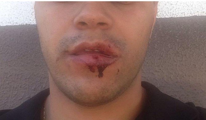 Padrasto em Colíder e acusado de socar enteado tirando sangue da boca do adolescente.
