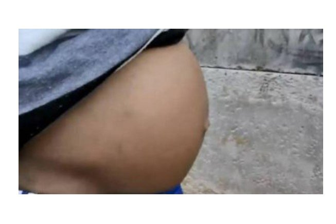 Padrasto estupra enteada por 7 anos; 2 filhos nascem de crime em MT