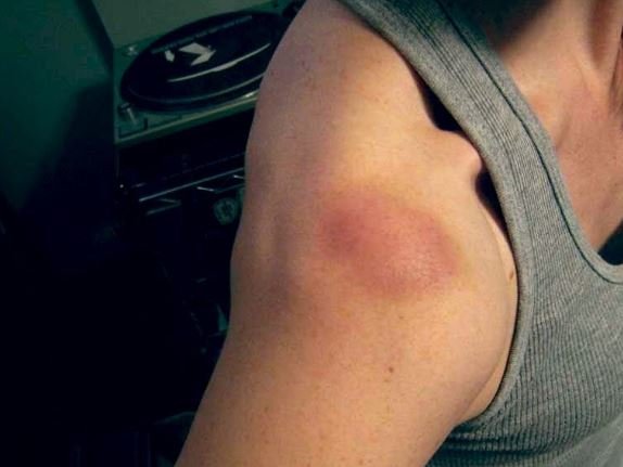 Em Colíder homem acusado de desferir uma facada em outro, relata sua versão sobre os fatos.