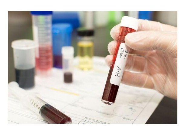 Paciente é declarado curado do HIV após receber células-tronco