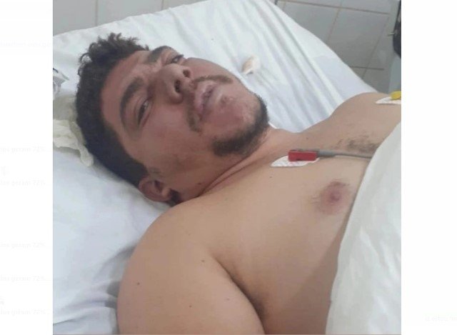 Autônomo em Colíder sofre acidente com explosão de gás e necessita de sua ajuda!