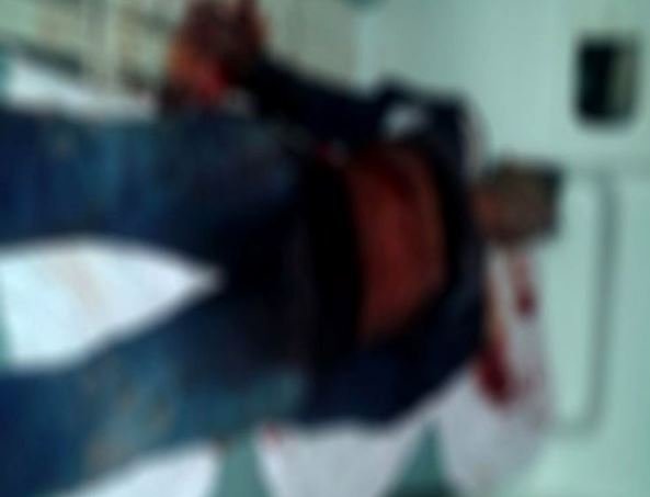 Em Cidade de Rondônia marido é esfaqueado nos testículos ao agredir mulher em residência