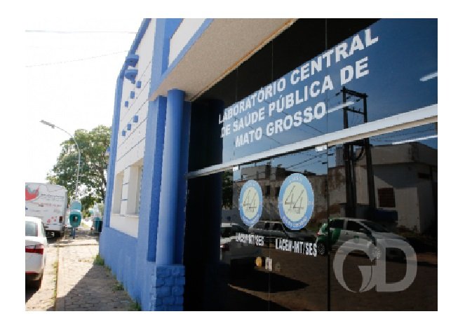 Saúde confirma 4 novos casos da varíola dos macacos em Mato Grosso