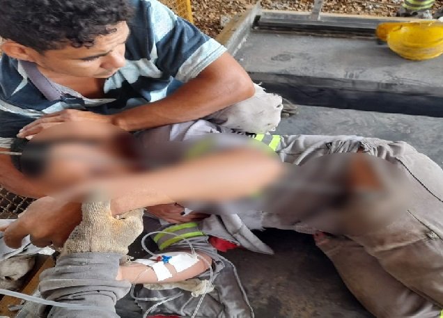 Trabalhador de construtora tem corpo transfixado por vergalhão de ferro em Sinop